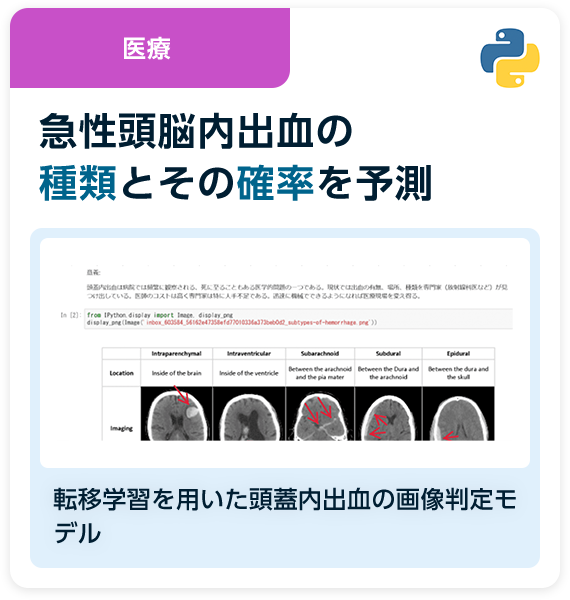 医療 急性頭脳内出血の種類とその確率を予測