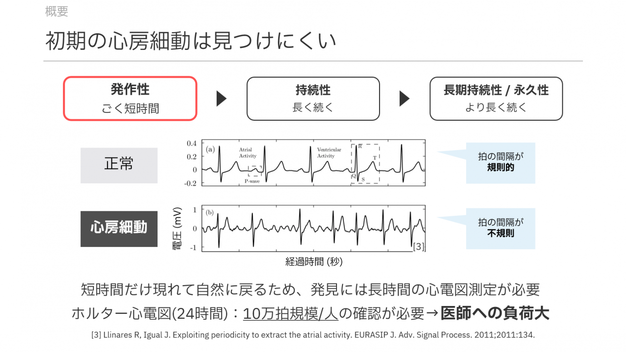 初期の心房細動は見つけにくい